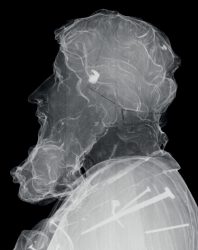 Paulus-xray_2-1-809x1024